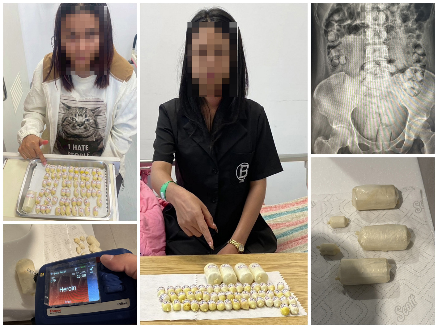 外籍女子吞食毒品搭機運毒  遭海巡於關口緝獲